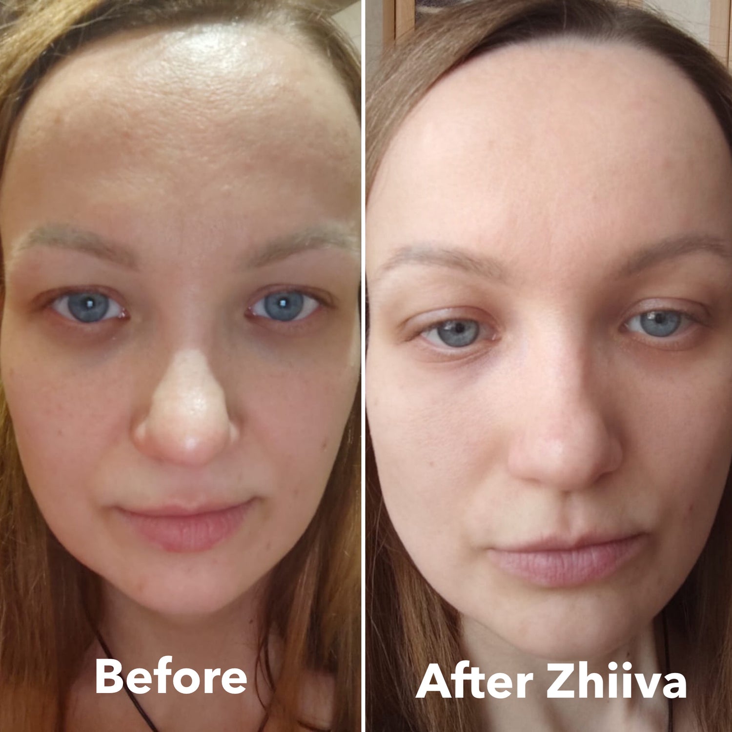 Zhiiva is a pure, organic, natural, chemistry-free face serum from the heart of Siberia. 